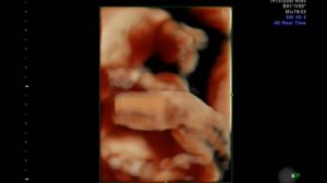 Беременность - 25 недель