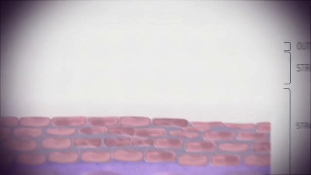 BARIEDERM | Protecting your skin from severe damage смотреть онлайн