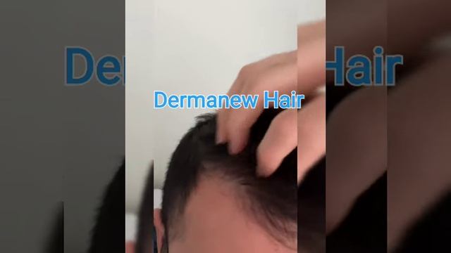 Eski saçlarınıza kavuşma garantisi saç çıkartan dermanew hair serum смотреть онлайн