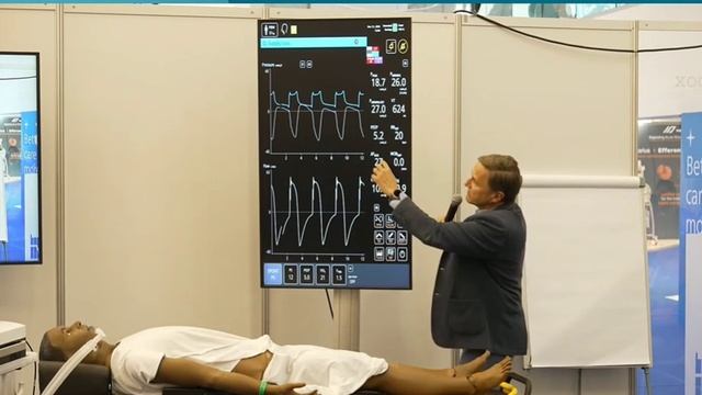 Managing  transition from controll ventilation to spontaneous ventilation M.Amato ISICEM-44 (2025)