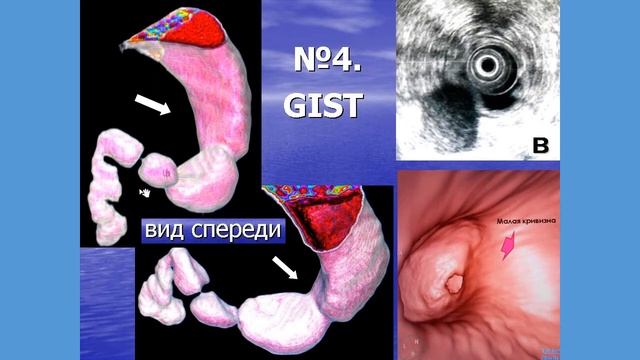 ГИСО смотреть онлайн