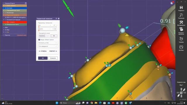 Exocad 3.1, Exocad Telescopic Crown Work. Easy Make Telescopic Crown.Телескопический калпачок.