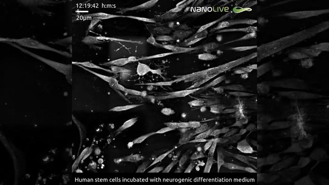 Human stem cells incubated with neurogenic differentiation medium смотреть онлайн