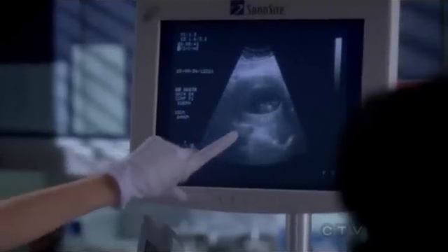 Mark/Callie 7.13 Clip 03 {Read Description} смотреть онлайн