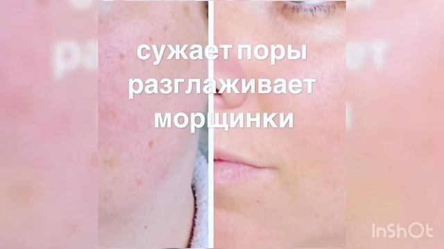 Биоревитализация без уколов с эффектом ВВ крема смотреть онлайн