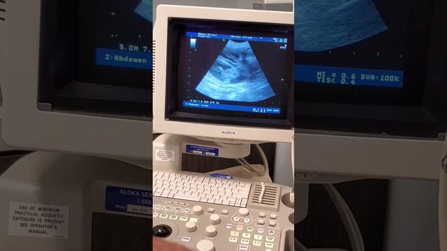 Morgan's Ultrasound May 2020 смотреть онлайн