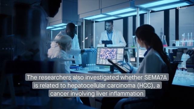 Semaphorin 7A mediates liver inflammation via interaction of integrin β1 with NF-κB p105 смотреть онлайн