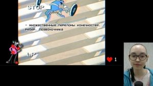 РЕАКЦИЯ НА КИНО ОГОНЬ ВСЕ ТРАВМЫ ВОЛКА ИЗ НУ, ПОГОДИ ГЛАЗАМИ ВРАЧА [ИСТОРИЯ БОЛЕЗНИ]