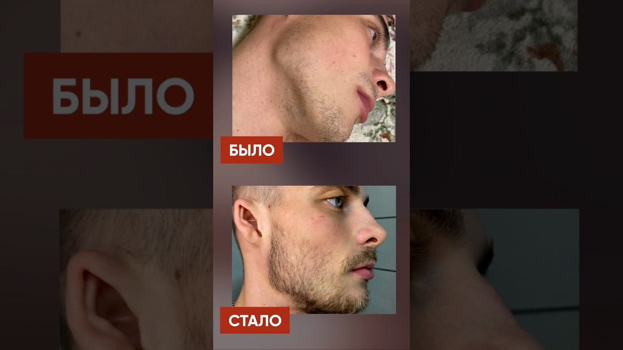 Год не использовал средство для роста волос смотреть онлайн