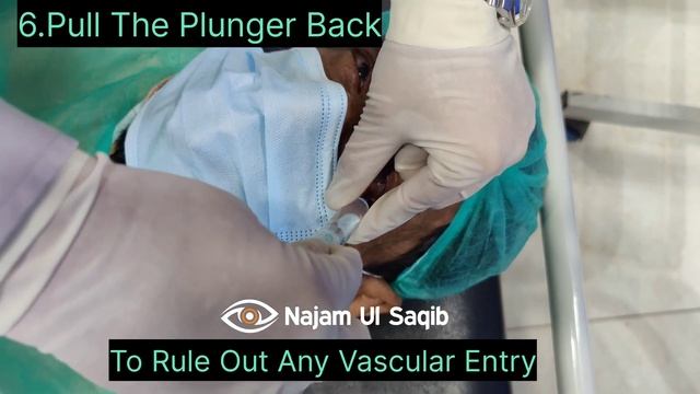 Peribulbar Anesthesia Technique. How To Achieve Adequate Akinesia For Ocular Surgery. смотреть онлайн