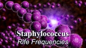СТАФИЛОКОКК*ИСЦЕЛЕНИЕ ЗВУКОМ*ЧАСТОТЫ РАЙФА