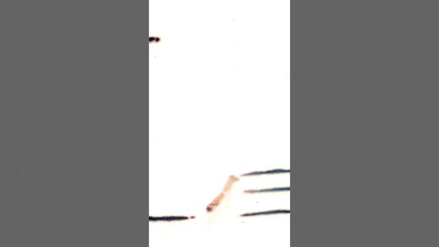 I'm alive - Jesus Christ saved my life!