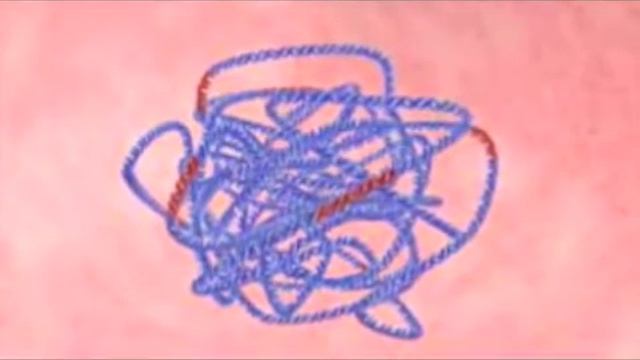 E coli смотреть онлайн