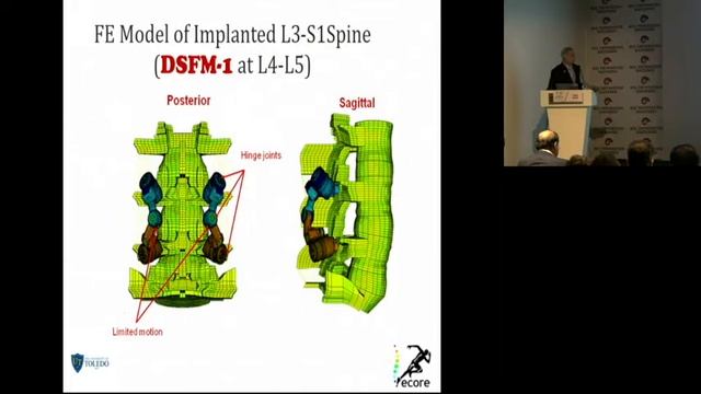 Vijay Goel Biomechanics of lumbar posterior dynamic stabilization смотреть онлайн