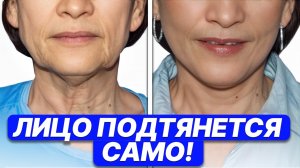 Косметологи НЕ ХОТЯТ, чтобы вы знали! СКРЫТЫЕ ПРИЧИНЫ птоза, как убрать обвисающее лицо?