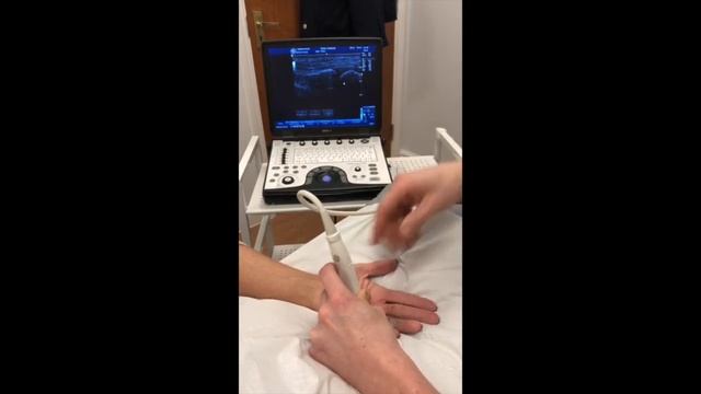 😩 👉 Finger Pain Treatment 👈Trigger Finger Treatment - Steroid Injection Cheltenham смотреть онлайн