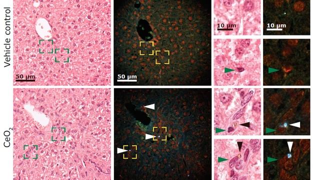 Localisation of nanoparticles in liver - in vivo and in vitro смотреть онлайн