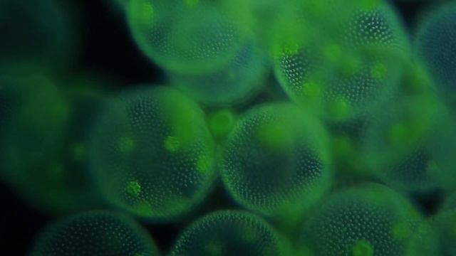 IBD Patients Are Left Out with Pain, Stress and Anxiety. Algae Could Be the Game Changer! смотреть онлайн