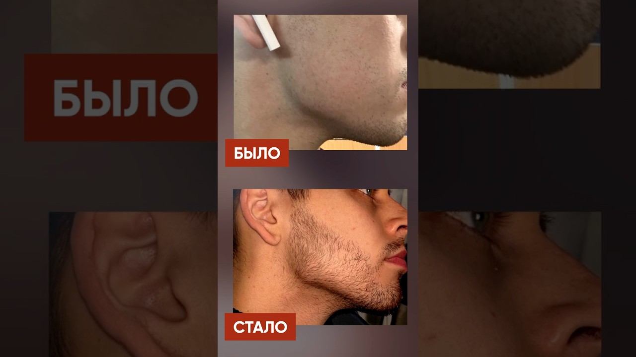 Результаты после использования Ксиноксина смотреть онлайн