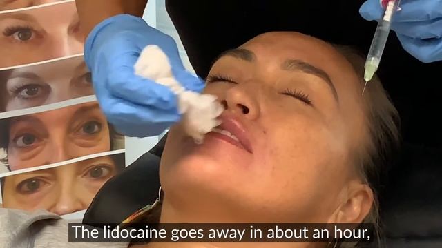 Watch This Amazing Lip Filler Procedure смотреть онлайн