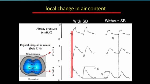 The importance of Pendelluft in NIV Marcelo Amato  ISICEM-44 (2025