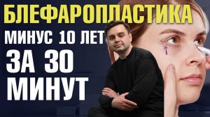 Блефаропластика верхних и нижних век | Реабилитация после пластики век. Доктор Золотов Сергей