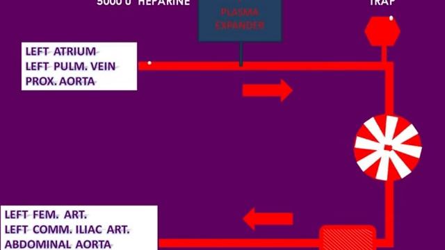 Spinal cord protection in aortic surgery смотреть онлайн