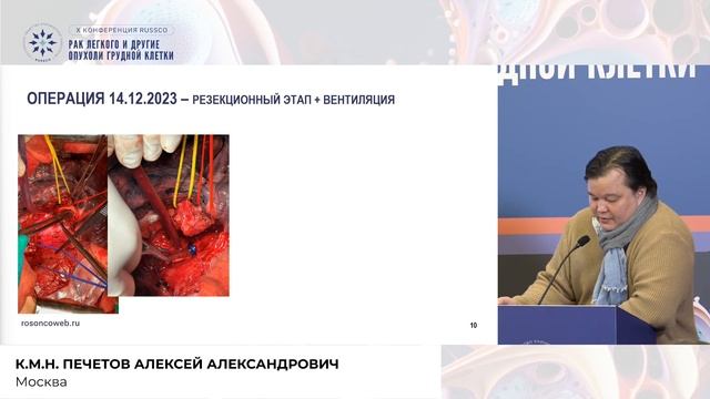 Стенозирующий рак дистального отдела трахеи с переходом на правый главный бронх, что делать? смотреть онлайн