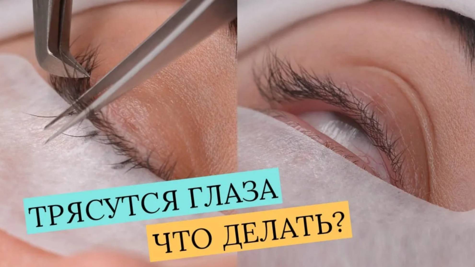 КАК НАРАЩИВАТЬ РЕСНИЦЫ, ЕСЛИ У КЛИЕНТА ТРЯСУТСЯ ГЛАЗА смотреть онлайн