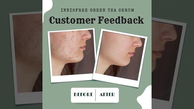 Hunting for PERFECT Serum? We have something SPECIAL for you... смотреть онлайн