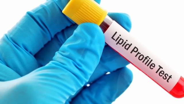 কোন রোগের জন্য কি টেস্ট করতে হয় | CBC Test | Blood Test | Urine Test | X-ray | S. Bilirubin смотреть онлайн