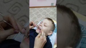 Постановка звука Р двумя зондами. Центр развития речи Галчонок. Рязань