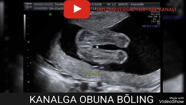 UY SHAROITIDA 1 SEKUNDDA HOMILA JINSINI ANIQLASH USULLARI HAQIDA MA'LUMOT. #HOMILA JINSINI ANIQLASH