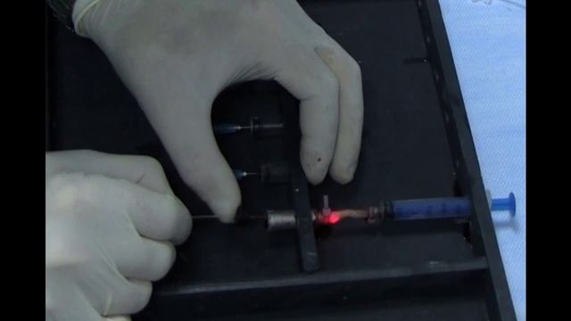 Карбонизация при ЭВЛО in vitro смотреть онлайн
