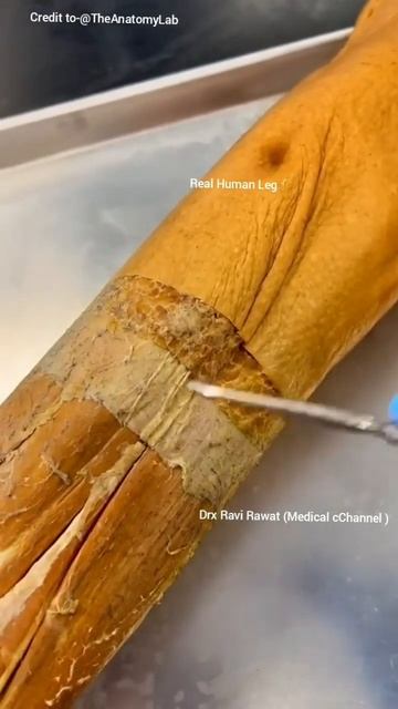 Real human leg skin layer, Epidermis, Dermis, Hypodermis fat layer смотреть онлайн