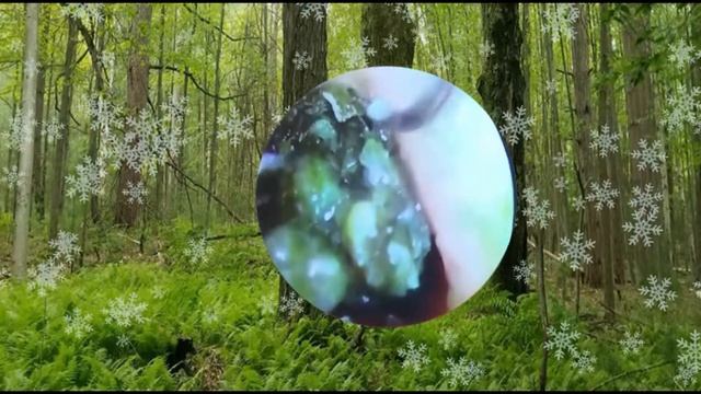 Ear Cleaning |чистка ушной серы