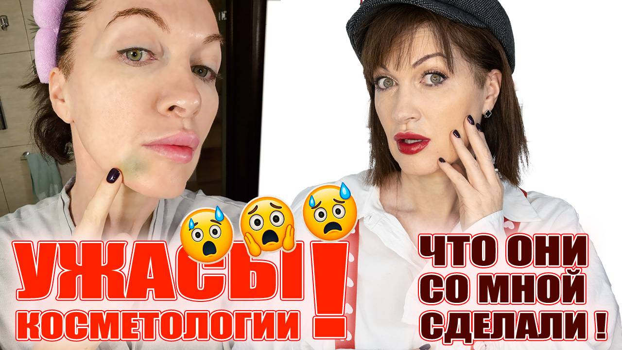 Что я сотворила со своим лицом! Ужас или спасение? смотреть онлайн