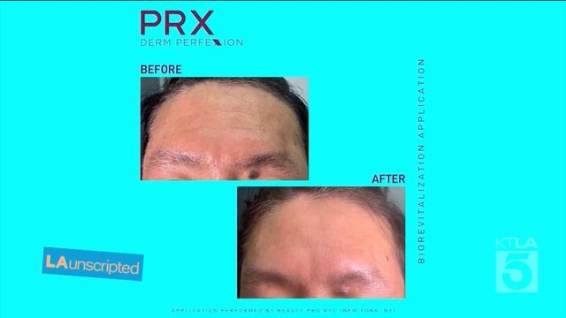 LA Unscripted on KTLA - STYLE SMART WITH ANYA SARRE: PRX Derm Perfexion with Dr. Ava Shamban смотреть онлайн