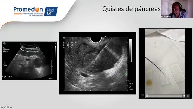 Curso de Introducción a EUS (Día 3) смотреть онлайн
