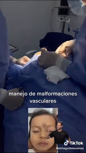 Manejo de malformaciones vasculares #hemangiomasinfantiles #hemangioma #malformacionesvasculares смотреть онлайн