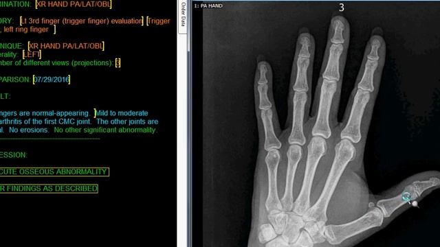 Fingers/DIgits Naming and Numbering смотреть онлайн