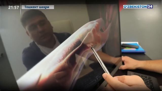 Бир вактнинг узида юракда амалга оширилган 3 та мураккаб операция. Ербеков Рустам Раимкулович. смотреть онлайн