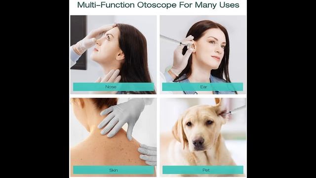 Campark Digital Otoscope with Ear Wax Remover Tool, 3.9mm Ear Camera, 6 LED Lights смотреть онлайн