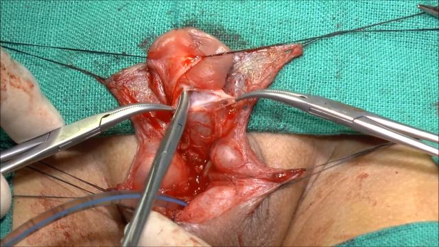 Pediatrics Surgery