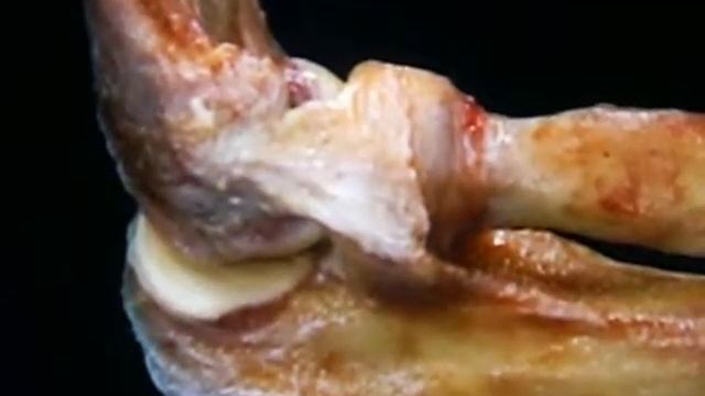 8 Codo Ligamentos смотреть онлайн