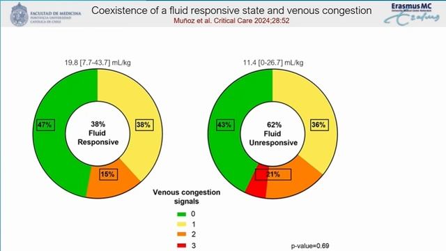 Venous congestion can be present in fluid responsive patients  Jan Bakker  ISICEM-44 (2025)