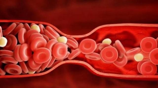 Sarımsağın Faydaları. Sarımsaq Haqda Faydali Melumatlar