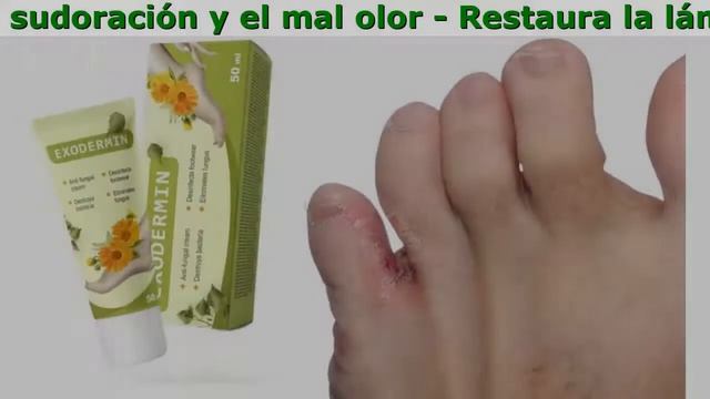 Exodermin Amazon смотреть онлайн