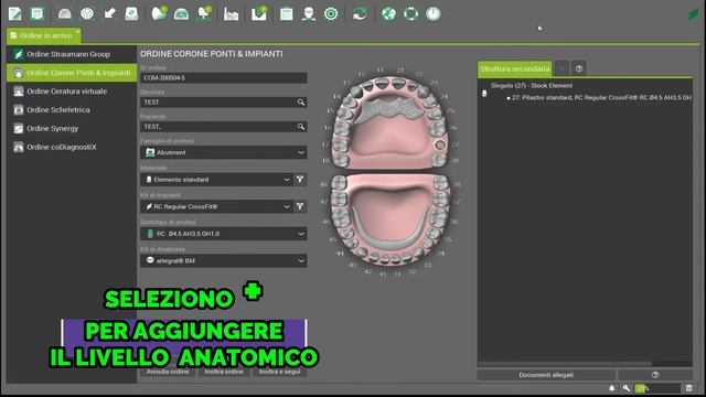 DENTAL WINGS: IMPORTAZIONE FILE INTRAORALI смотреть онлайн