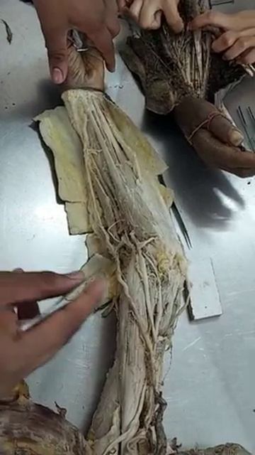 BRACHIAL ARTERY |ANATOMY| смотреть онлайн